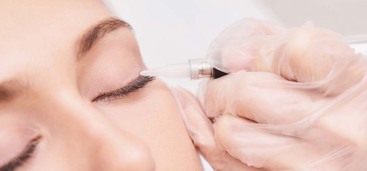 Lidstrich permanent Bremen