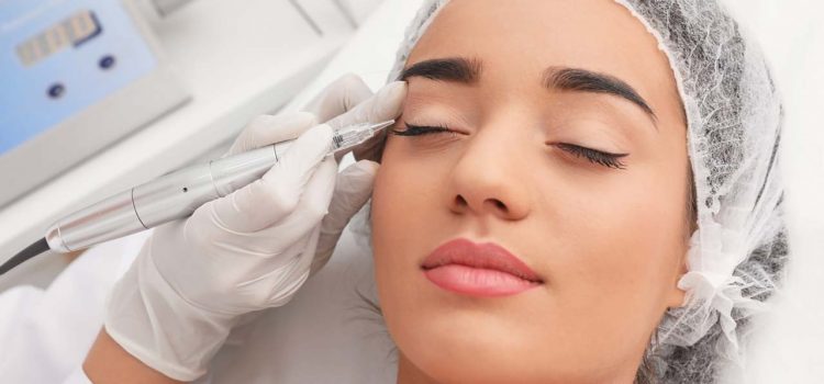 Lidstrich permanent Kassel