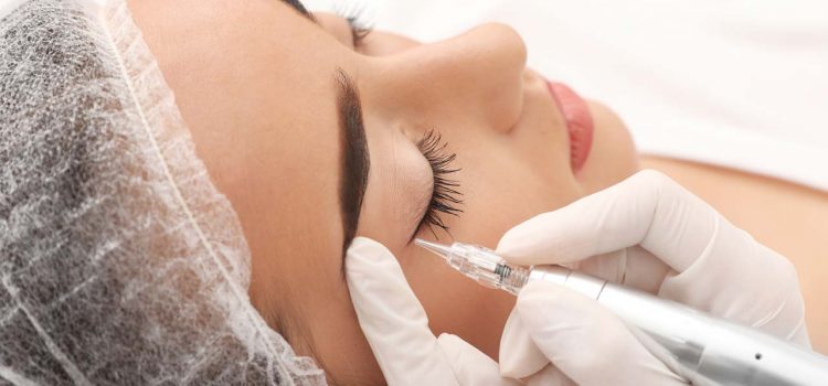 Lidstrich permanent Recklinghausen