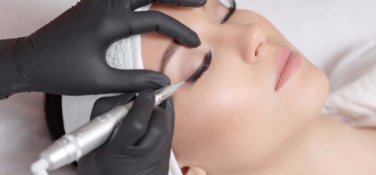 Lidstrich permanent Salzgitter