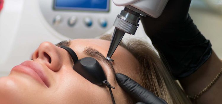 Permanent Make-up entfernen Gelsenkirchen