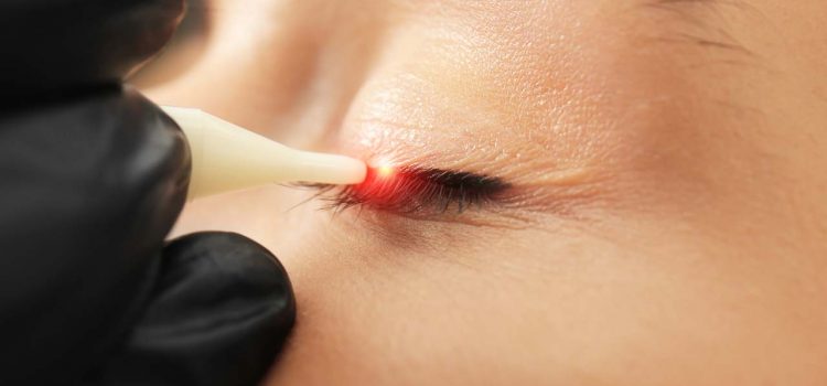 Permanent Make-up entfernen Hildesheim