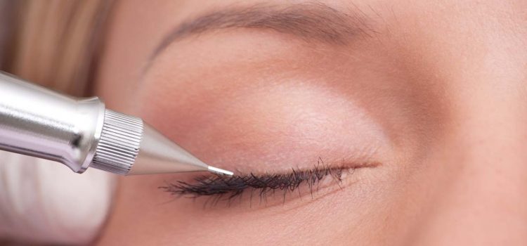 Lidstrich permanent Wuppertal