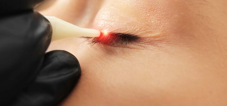 Permanent Make-up entfernen Kaiserslautern
