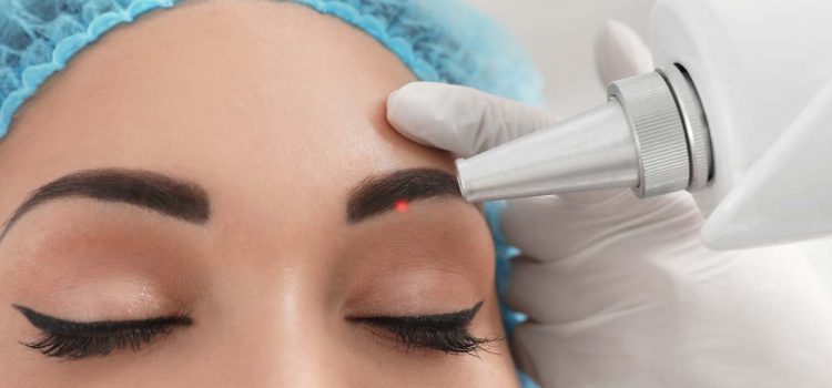 Permanent Make-up entfernen Oldenburg